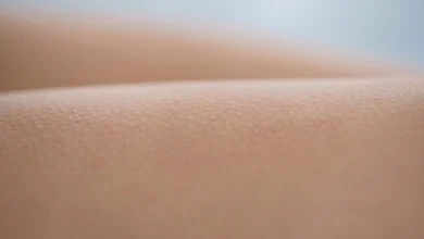 ازاي أتخلص من جلد الوزة في البيت