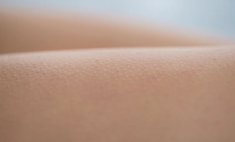 ازاي أتخلص من جلد الوزة في البيت