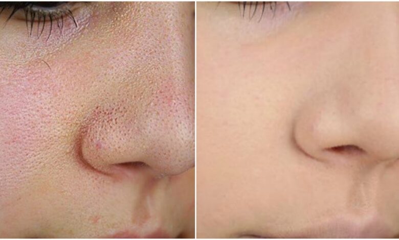 ازاي تحافظ على بشرة زجاجية لامعة في الصيف