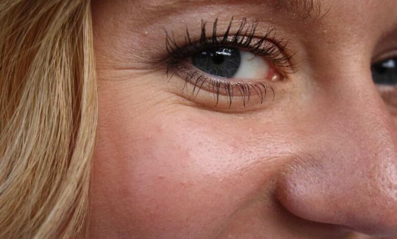 كريم موضعي لإزالة التجاعيد حول العين.. طريقة إزالة تجاعيد العين بسرعة؟
