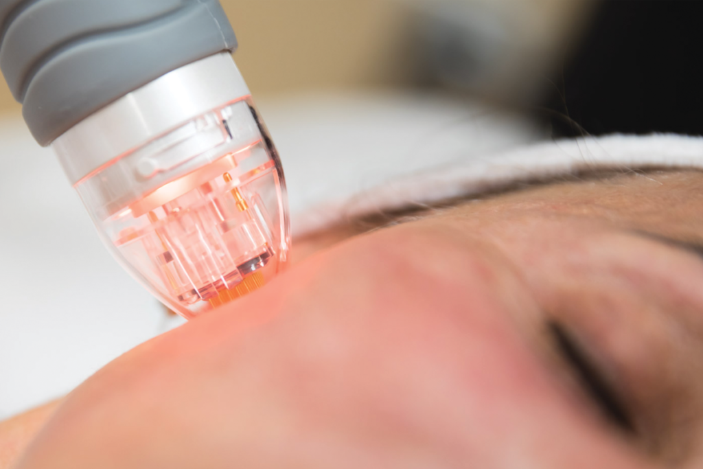 هل جلسات تنظيف البشرة مضرة؟ 2 هل جلسات تنظيف البشرة مضرة؟