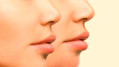 وصفة طبيعية لزيادة الوزن فعالة وسريعة 5 وصفة طبيعية لزيادة الوزن فعالة وسريعة