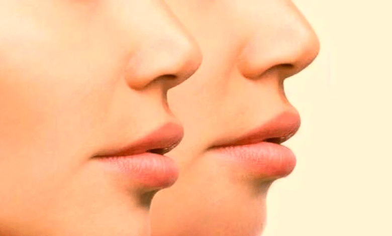 وصفة طبيعية لزيادة الوزن فعالة وسريعة