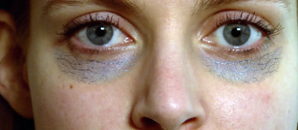 ازاي أتخلص من الهالات السوداء تحت العين؟