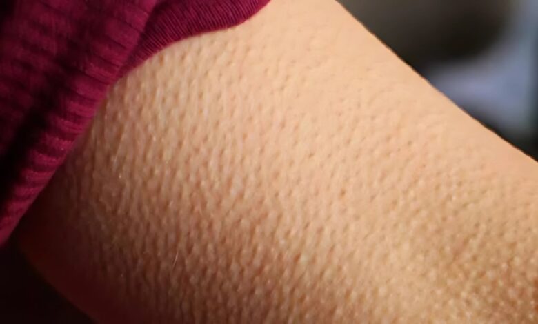 كم يستغرق علاج جلد الوزة؟ 4 كم يستغرق علاج جلد الوزة؟