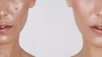 كيفية التخلص من إفرازات الدهون من الوجه