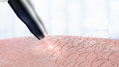 لماذا ينمو شعر الإبط بسرعه بعد الليزر؟