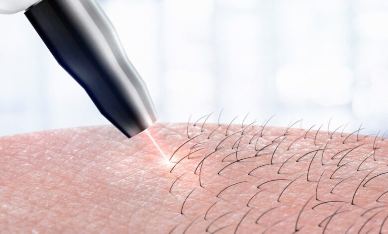 لماذا ينمو شعر الإبط بسرعه بعد الليزر؟ 6 لماذا ينمو شعر الإبط بسرعه بعد الليزر؟