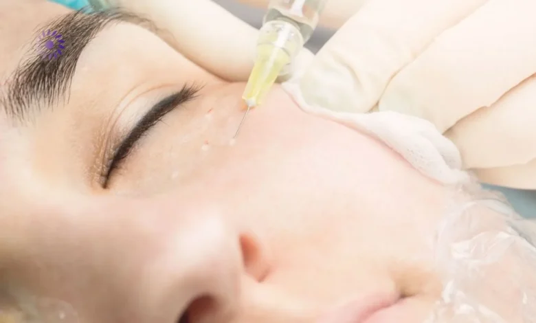 هل حقن البوتوكس تحت العين يسبب أضرار؟