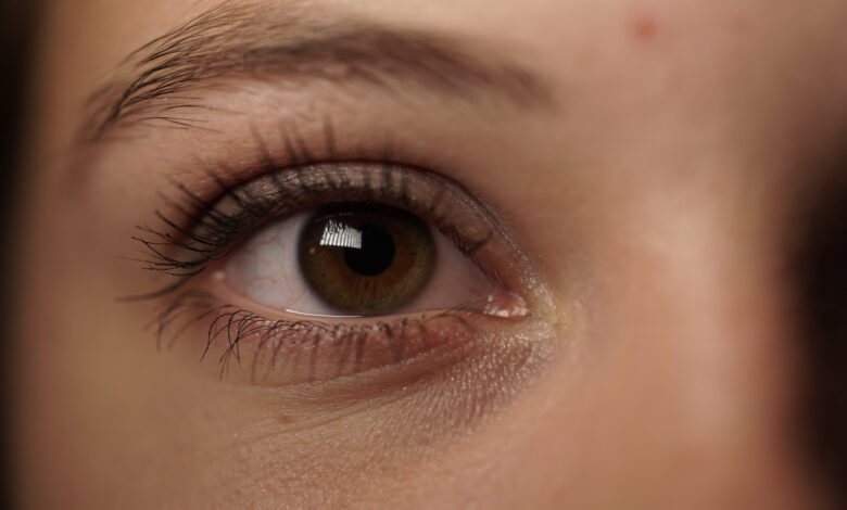 هل حقن البوتوكس تساعد في إزالة الهالات السوداء تحت العين؟ 1 هل حقن البوتوكس تساعد في إزالة الهالات السوداء تحت العين؟