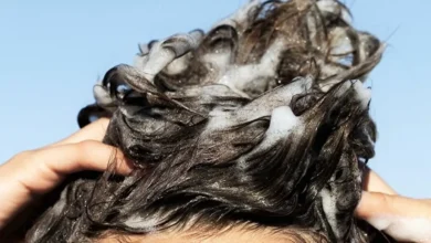 وصفة طبيعية للتخلص من القشرة للشعر