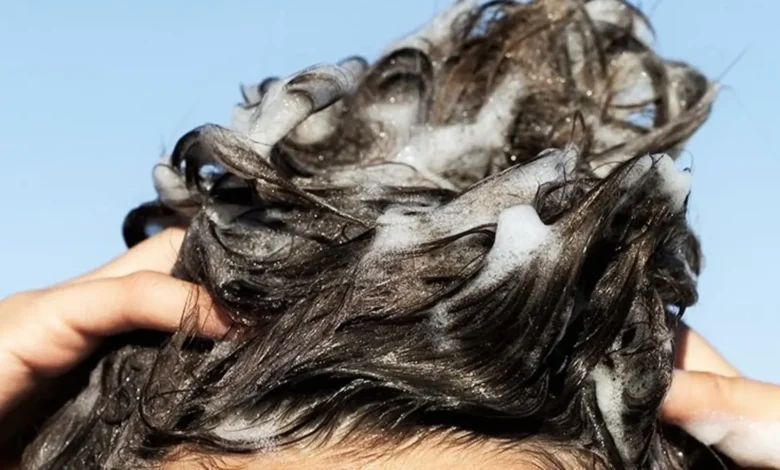 وصفة طبيعية للتخلص من القشرة للشعر