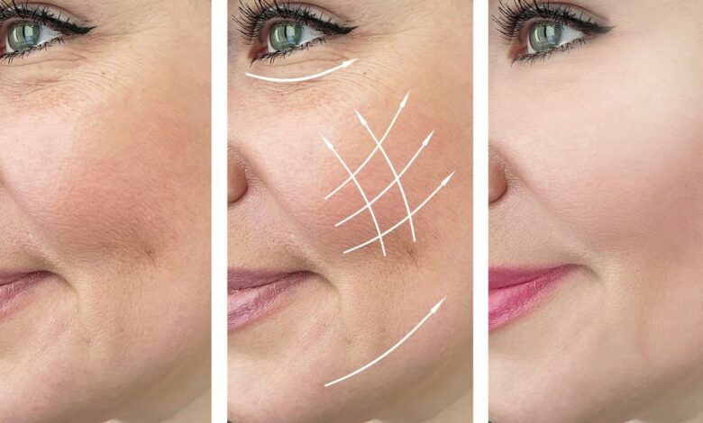 هل إبرة النضارة مفيدة لجميع أنواع البشرة؟ 1 هل إبرة النضارة مفيدة لجميع أنواع البشرة؟