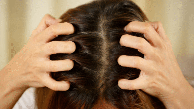 حلول علاجية لفروة الرأس..لأن الشعر الجميل يبدأ من عناية صحية