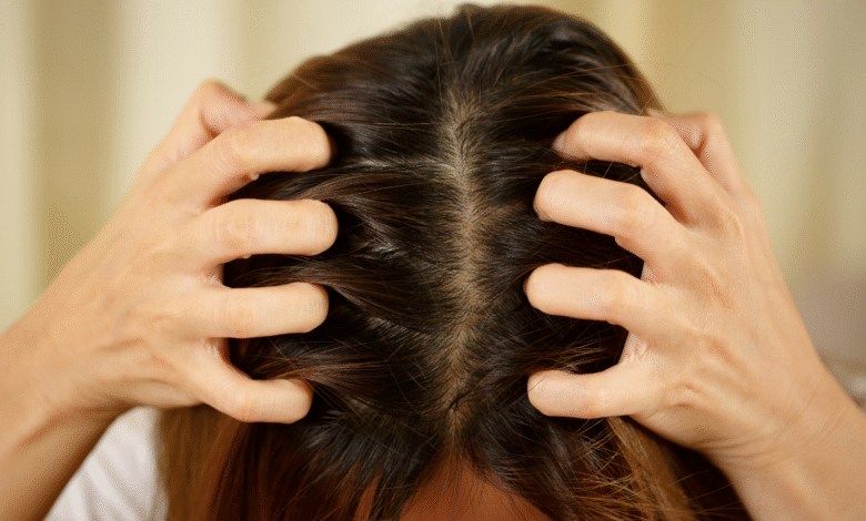 حلول علاجية لفروة الرأس..لأن الشعر الجميل يبدأ من عناية صحية