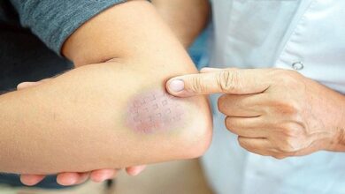 عادات تصيب الجسم بجلطات الدم دون أن تدري