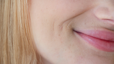 أسرع طريقة للتخلص من الاسمرار والسواد حول الفم 4 أسرع طريقة للتخلص من الاسمرار والسواد حول الفم