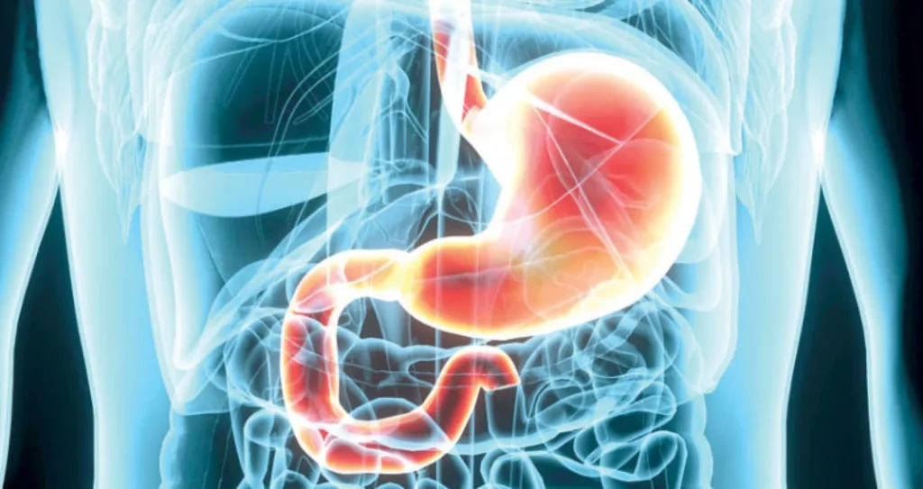 تحذير جديد: نظام غذائي صحي قد لا يحمي من سرطان الرئة كما نعتقد