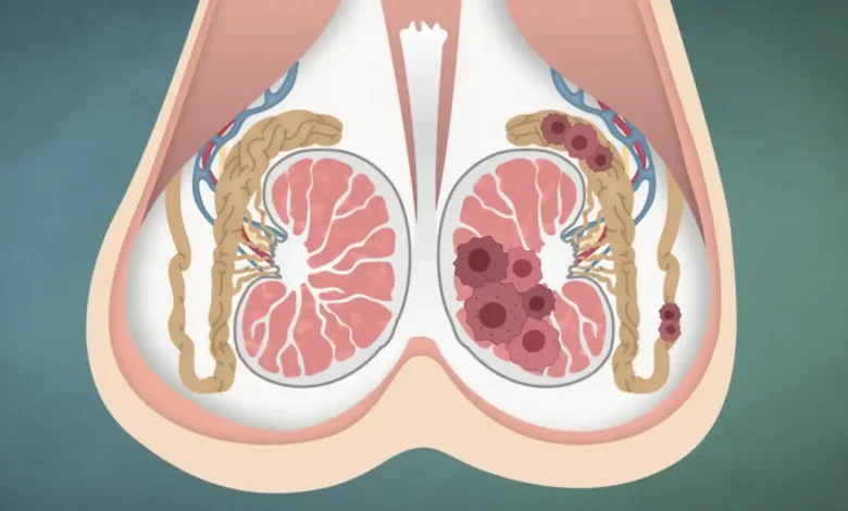 تحذير جديد: نظام غذائي صحي قد لا يحمي من سرطان الرئة كما نعتقد