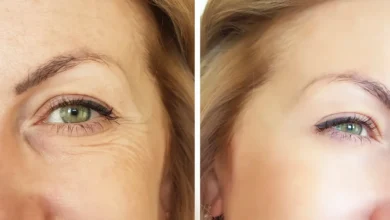 وداعًا للتجاعيد سريعًا: أفضل لاصقات العيون كبديل للبوتوكس 2026