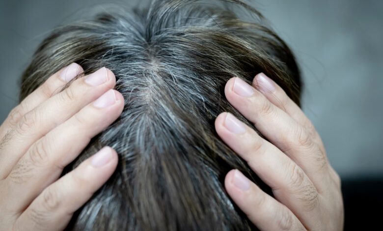 وصفات طبيعية لإخفاء الشعر الأبيض بدون صبغات 1 وصفات طبيعية لإخفاء الشعر الأبيض بدون صبغات