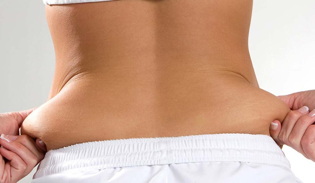 أسباب الدهون في منطقة البطن وطريقة التخلص منها
