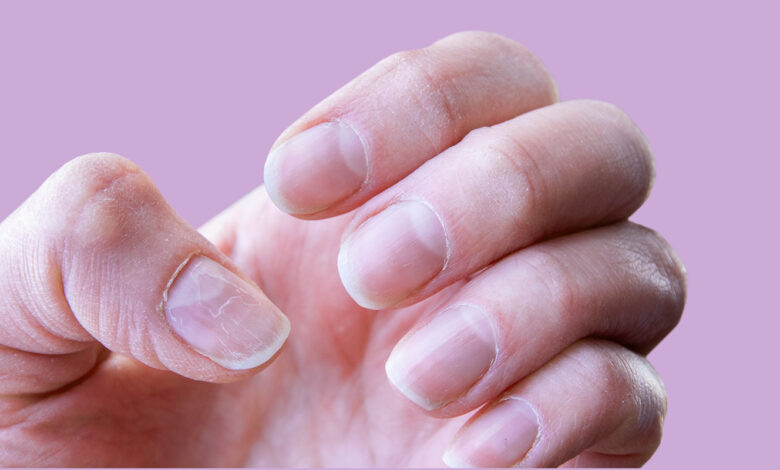 أطعمة غنية بالفيتامينات والمعادن للمساعدة على نمو أظافر صحية