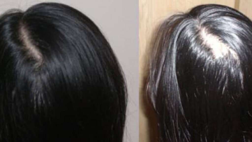 وصفة طبيعية في المنزل لملء الفراغات في الشعر.. كيف أعالج فراغات الشعر في البيت؟