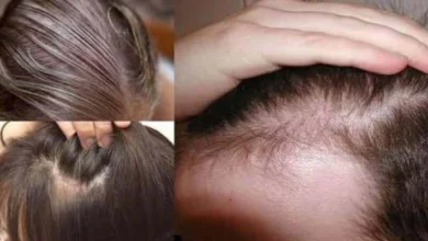 وصفة طبيعية في المنزل لملء الفراغات في الشعر.. كيف أعالج فراغات الشعر في البيت؟