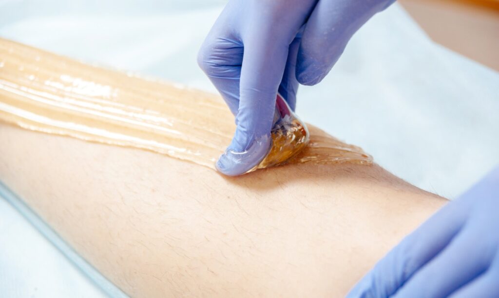 ازاي أتخلص من الشعر تحت الجلد نهائياً