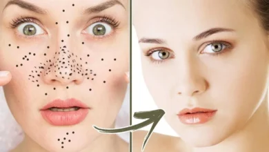 وصفة طبيعية للتخلص من الرؤوس السوداء في الوجه