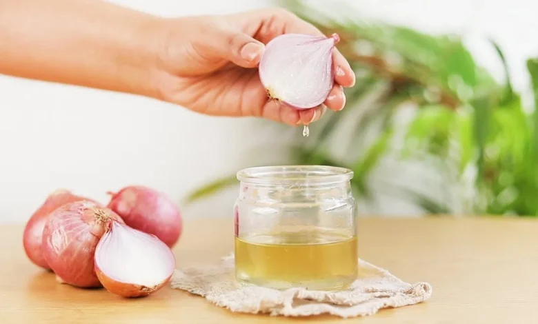 هل ماء البصل يسبب تساقط الشعر؟