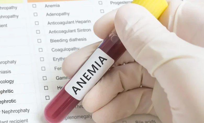 دليل النساء لرفع مخزون الحديد طبيعيًا.. نصائح طبية موثوقة