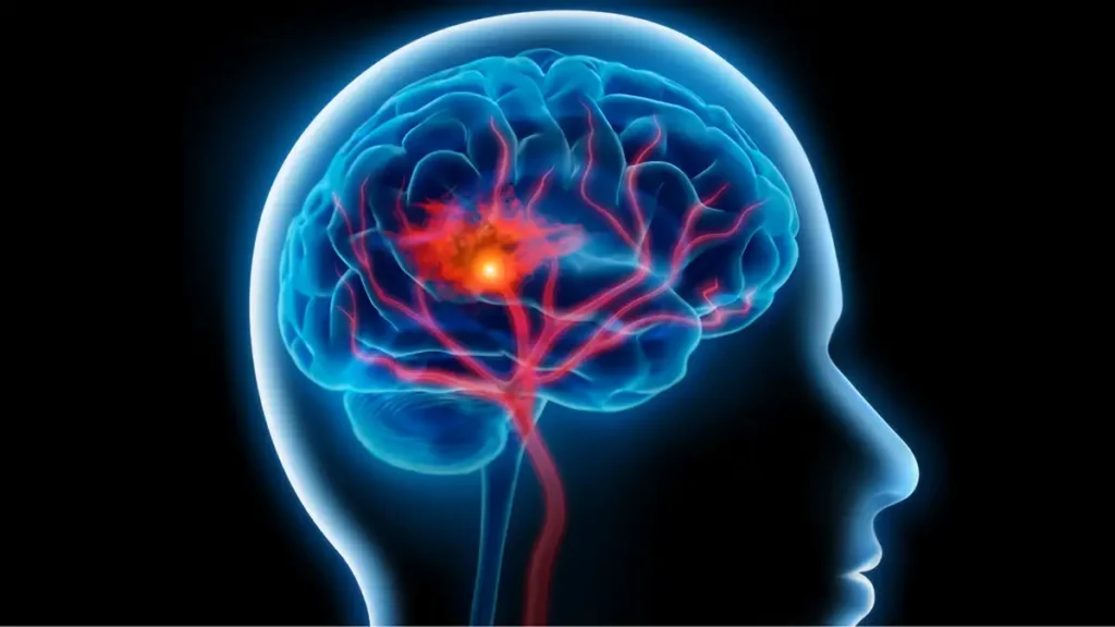 عادات تصيب الجسم بجلطات الدم دون أن تدري 2 عادات تصيب الجسم بجلطات الدم دون أن تدري