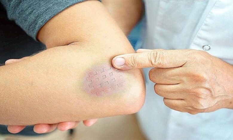 عادات تصيب الجسم بجلطات الدم دون أن تدري 7 عادات تصيب الجسم بجلطات الدم دون أن تدري
